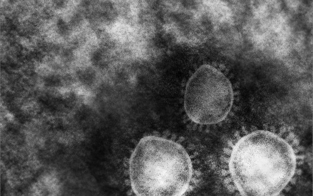 株式会社ジャストライト浪岡智がお送りするコロナウィルスのニュースのイメージ画像